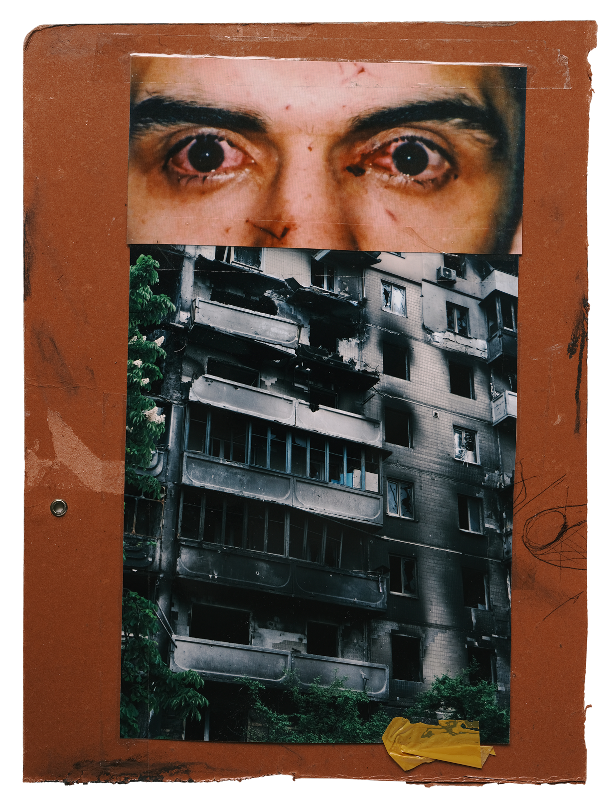 Collage featuring two photographs: one image is a close up of a man’s bloodshot eyes and injured face. The second image is a burnt out building.